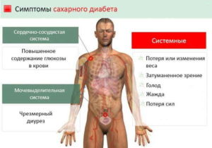 Скрытый сахарный диабет