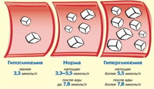 Преддиабет: симптомы и норма сахара в крови