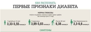 Как диагностируют СД?