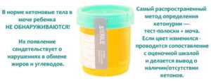 Ацетон в моче при сахарном диабете