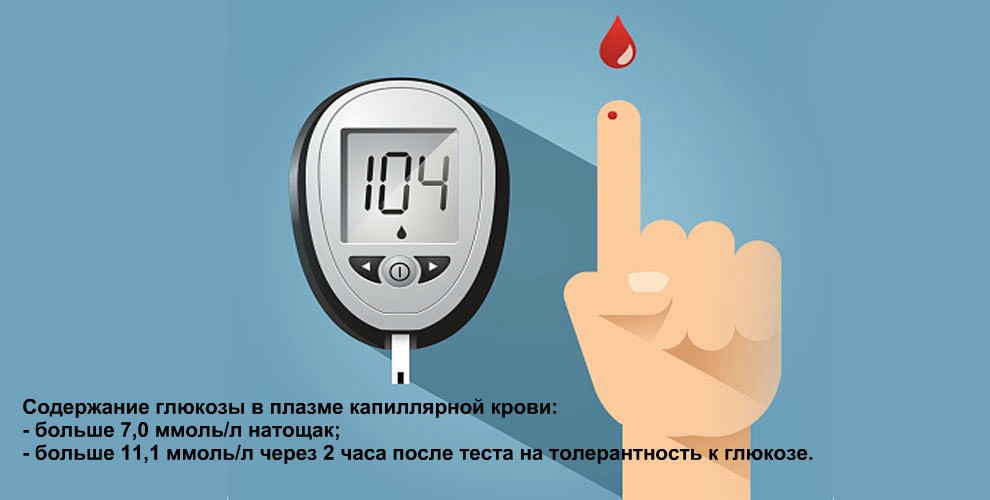 Диагностика сахарного диабета 1 типа