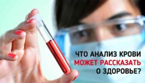 Общий анализ крови при сахарном диабете