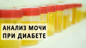 Анализ мочи при сахарном диабете