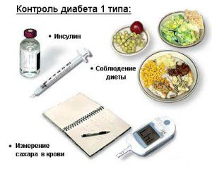 Сахарный диабет 1 типа: причины, симптомы, диагностика, лечение