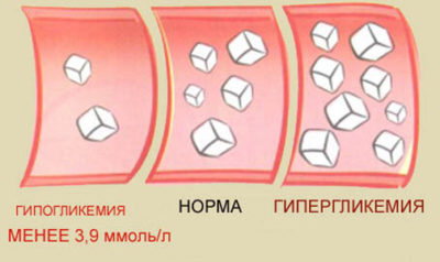 Торт для диабетиков: как приготовить, рецепт