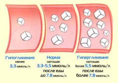 Гипогликемические препараты, средства: какой эффект ожидать? Гипогликемические препараты, средства: какой эффект ожидать?