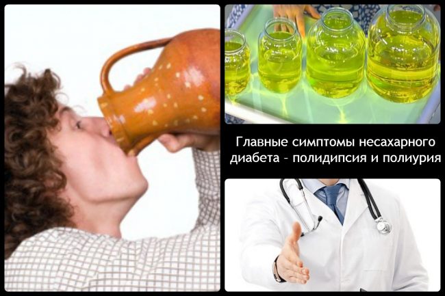 Симптомы и лечение несахарного диабета у детей